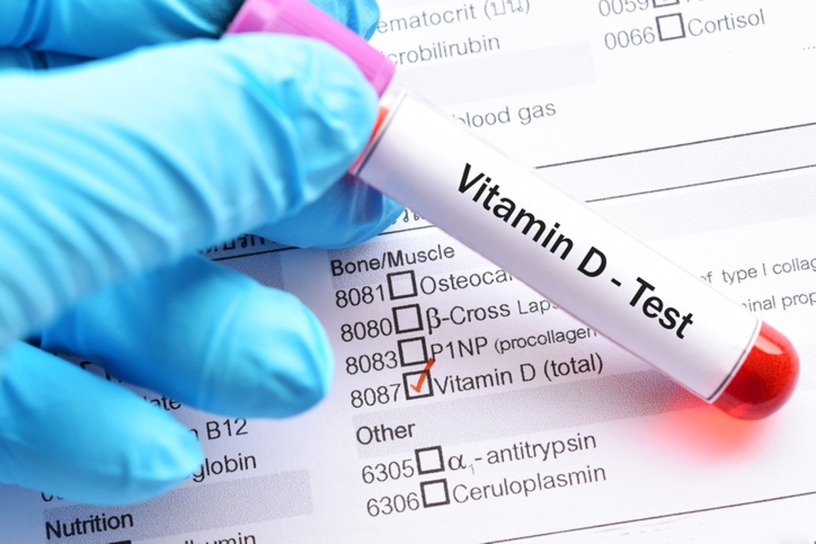 Analisis Vitamina D OH-25